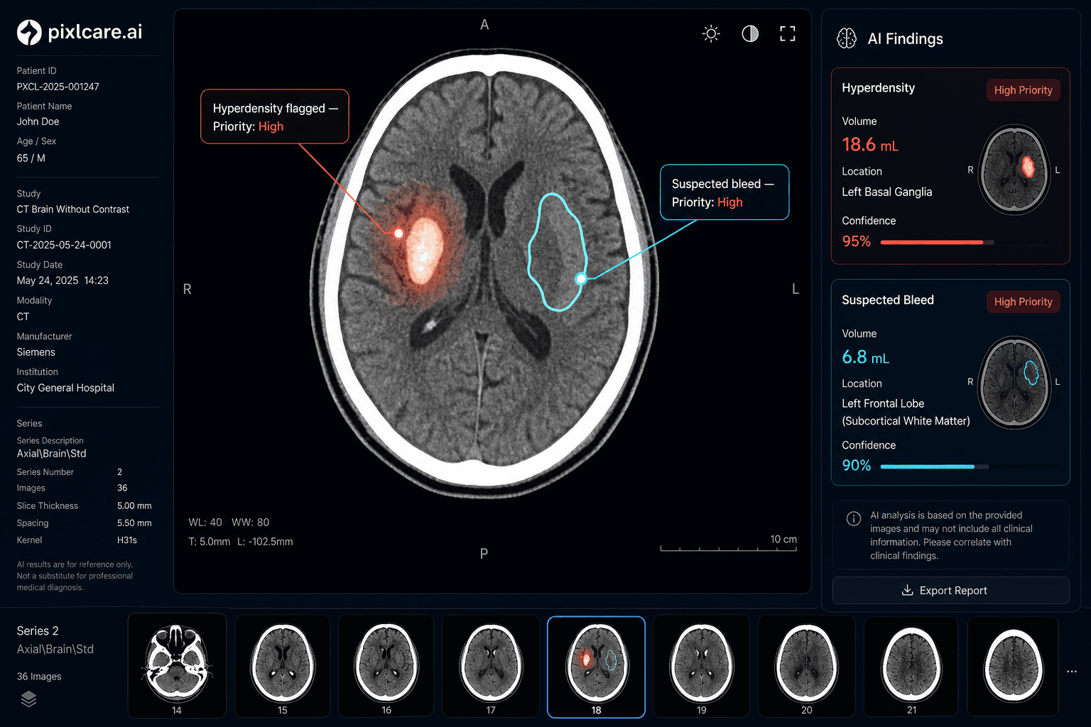 Focused support for hemorrhage and bleed pathways